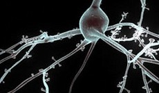 © EPFL, Neuron © EPFL, Neuron